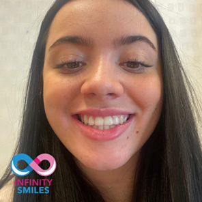 Infinity smiles Infinity smiles