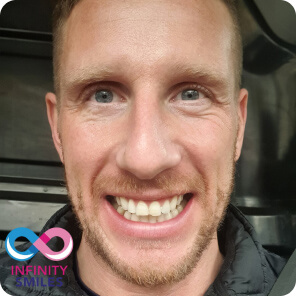 Infinity smiles Infinity smiles